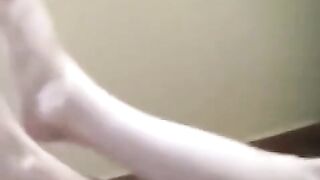 A naked girl was severely burned after being left alone with a cigarette